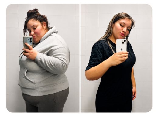Javiera, antes y después de su cirugía bariátrica